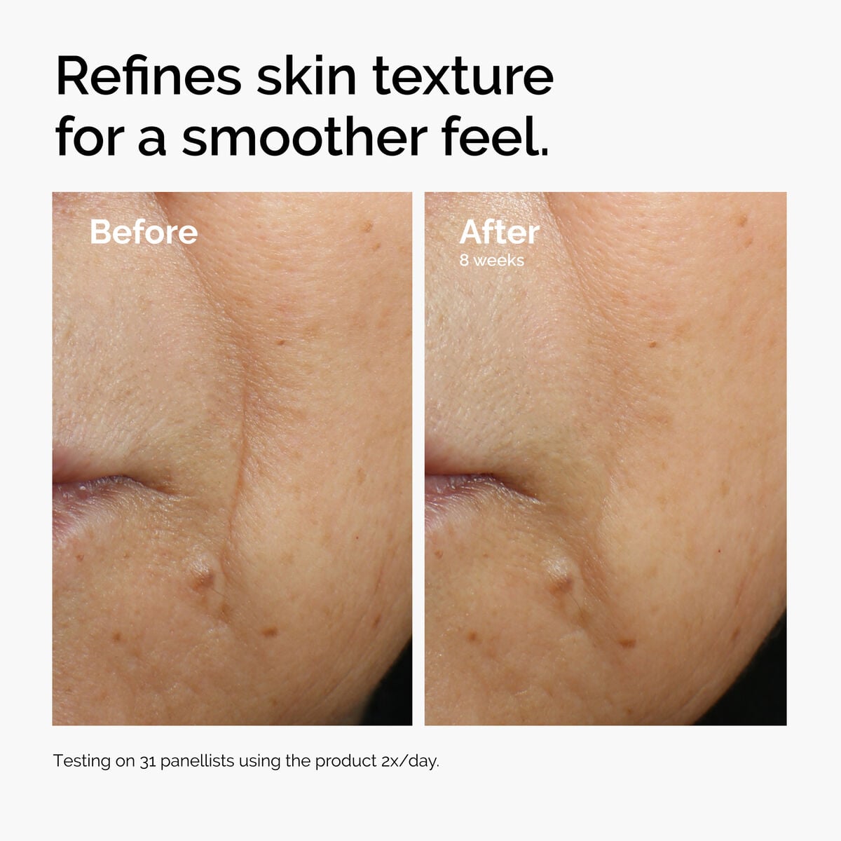 Caffeine + Escin Face Serum Targeted Serum Care C3