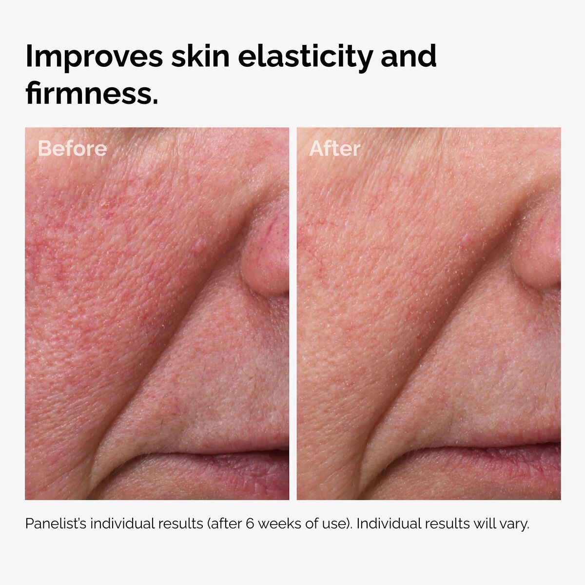Fermented Rose Hip Seed Oil Nourishing Face Oil Z5