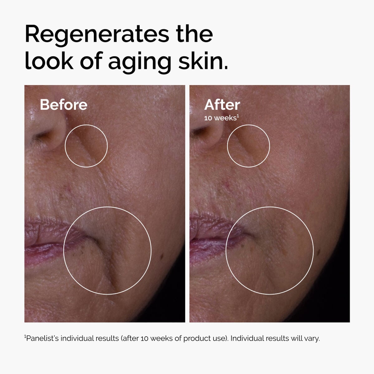 GF Solution Targeted Serum Care P5