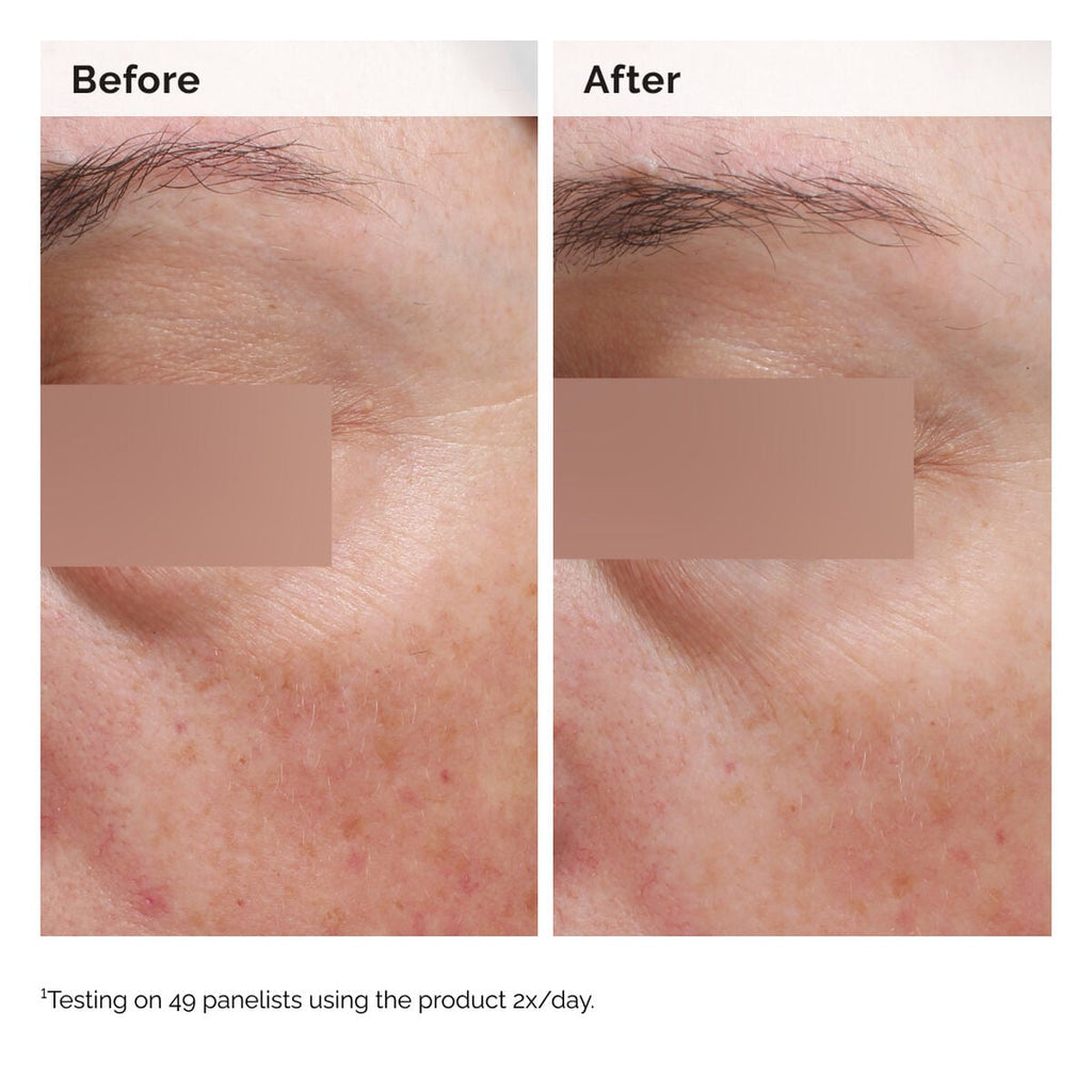 Niacinamide 5% Face and Body Emulsion Targeted Serum Care
