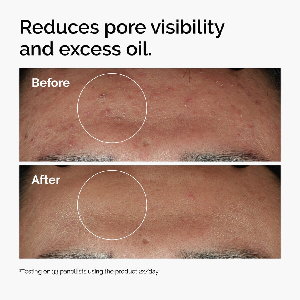 Niacinamide + Zinc Targeted Serum Care Q2