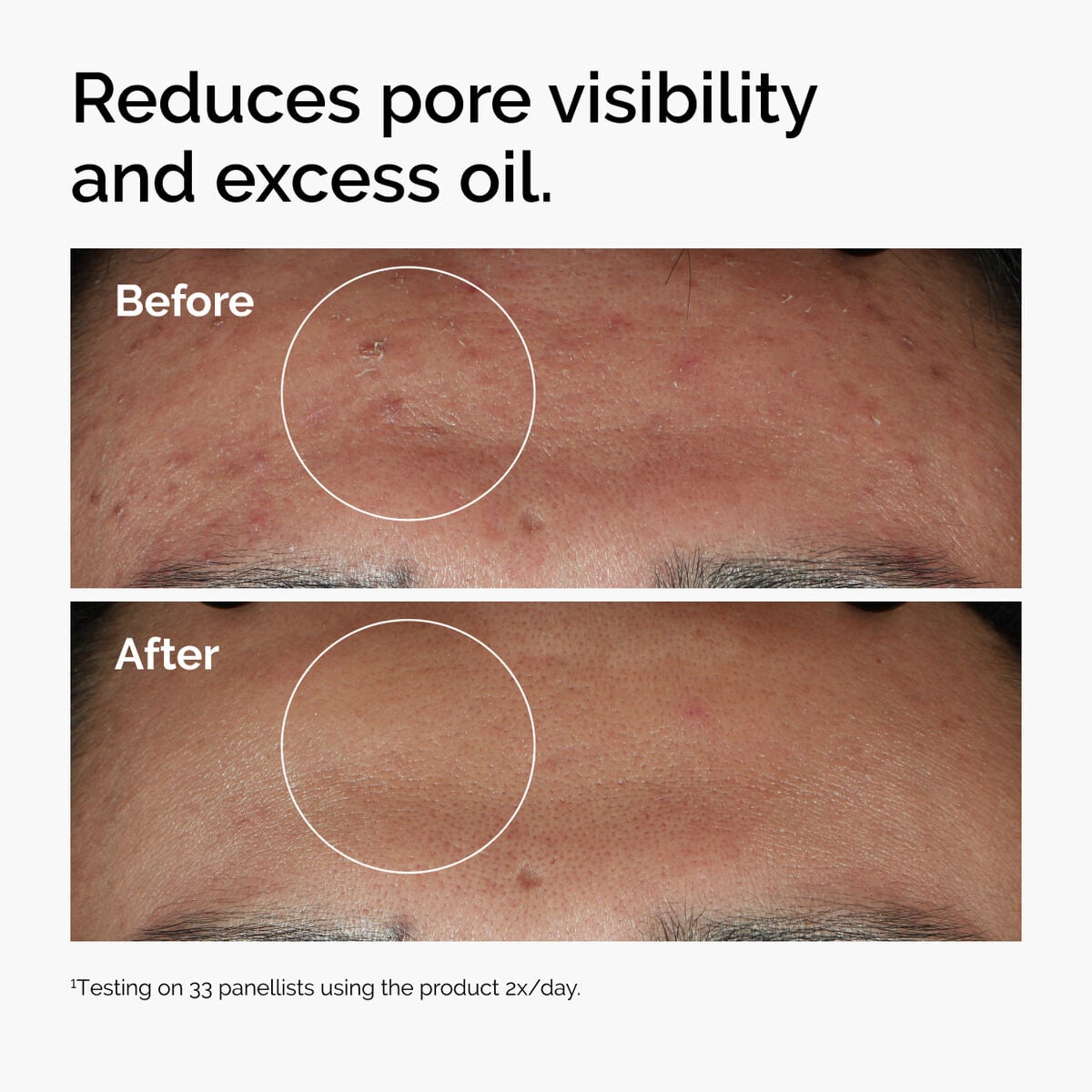 Niacinamide + Zinc Targeted Serum Care Q2