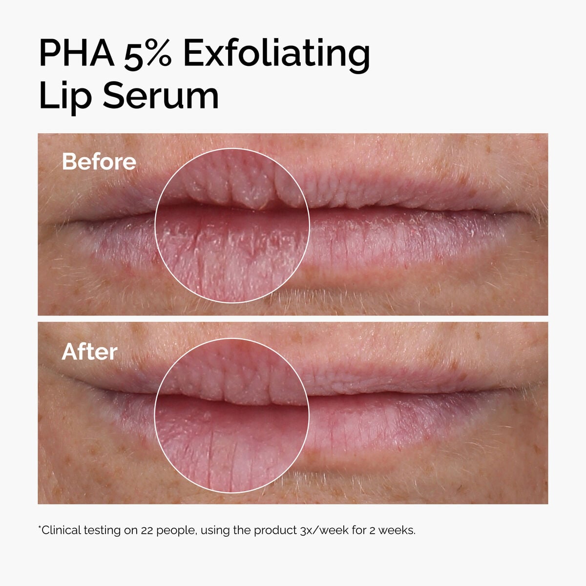 PHA Exfoliating Lip Serum Daily Treatment Ritual C9