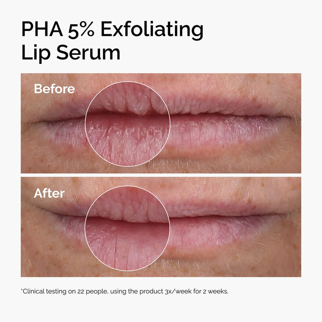 PHA Exfoliating Lip Serum Targeted Serum Care O7