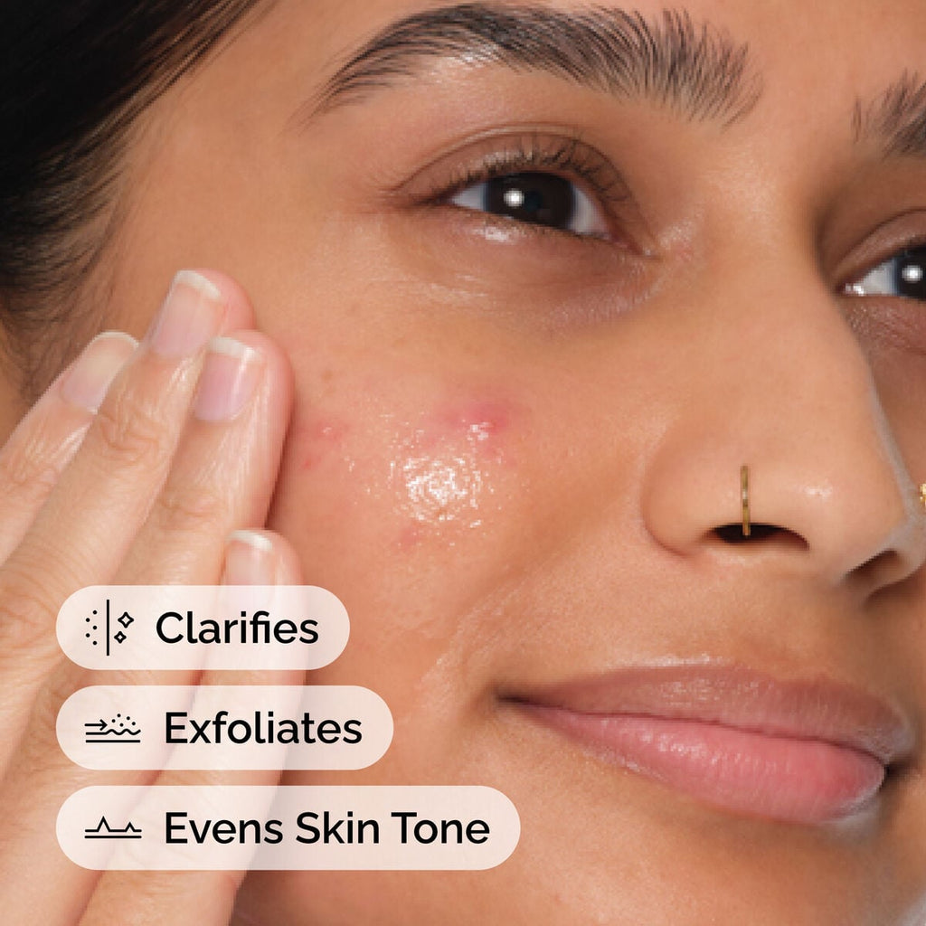 Salicylic Acid Anhydrous Solution Targeted Serum Care V9