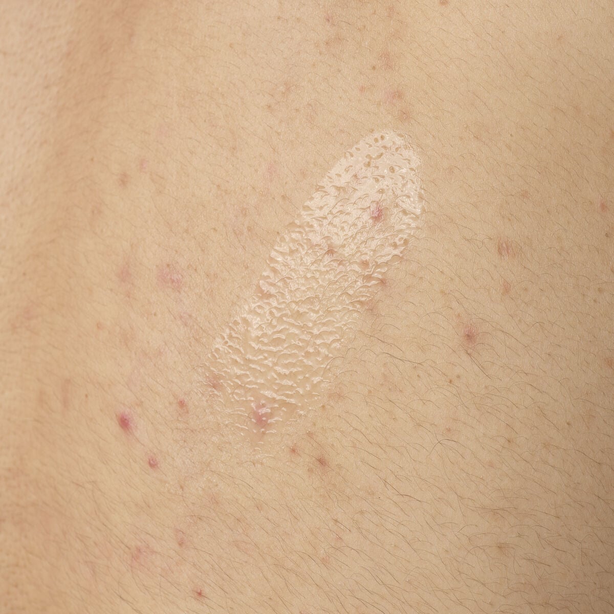 Salicylic Acid 0.5% Body Serum Targeted Serum Care