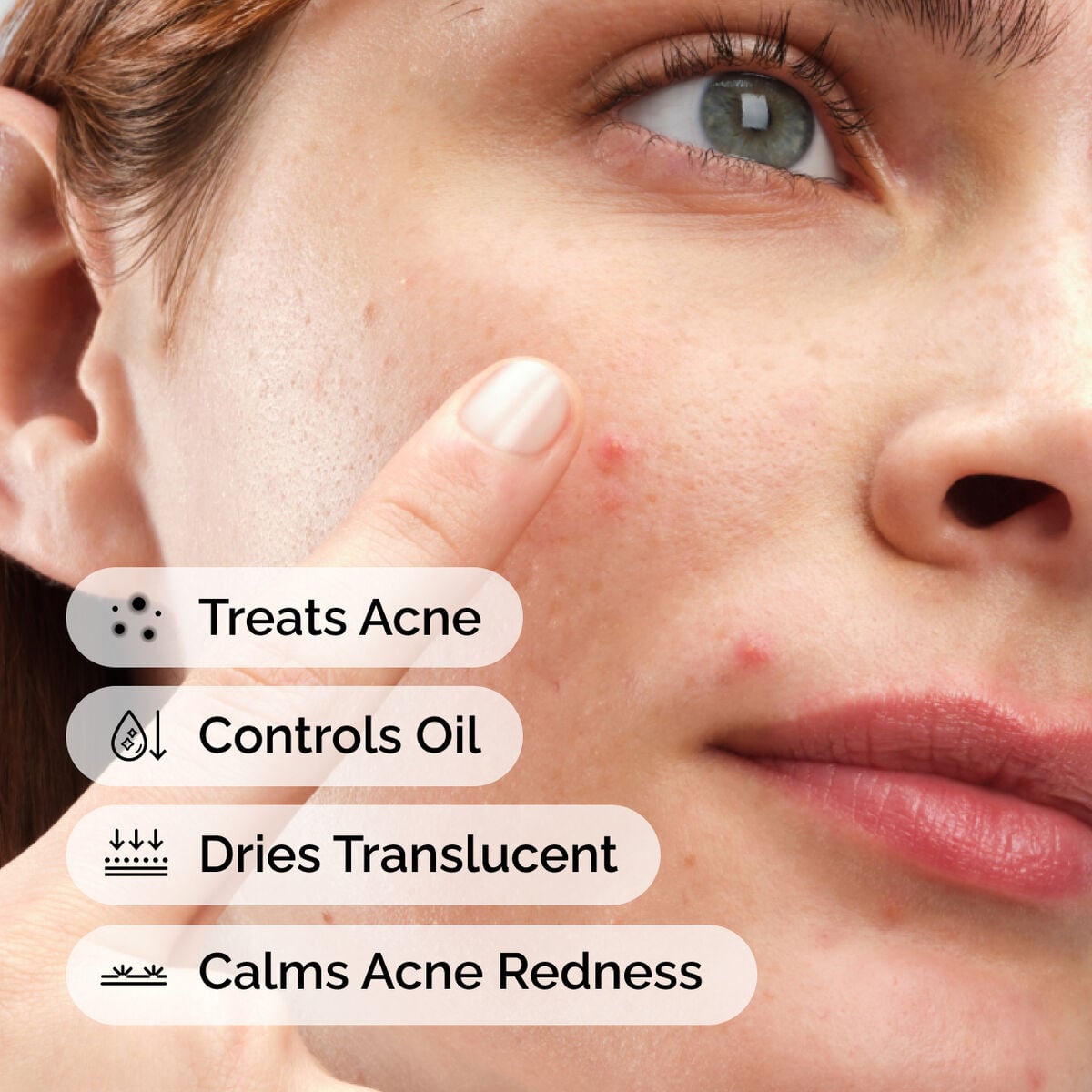 Sulfur 10% Powder-to-Cream Concentrate Targeted Serum Care